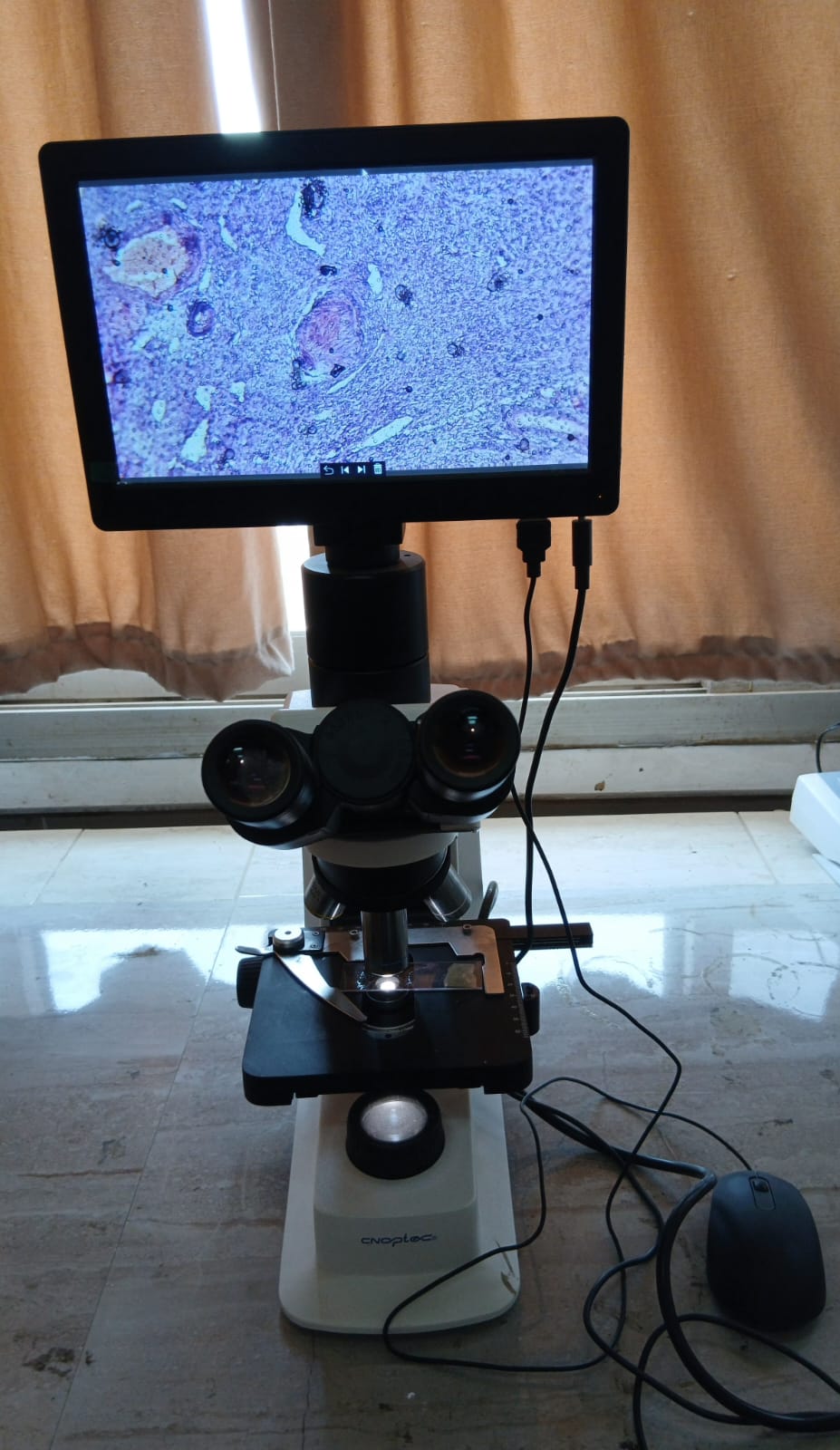 Digital microscope